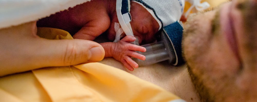 Foto på ett för tidigt fött barn som vilar på pappans bröstkorg