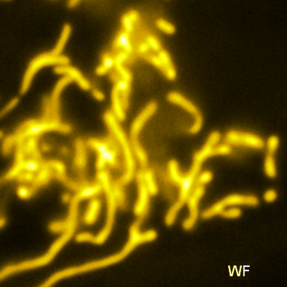 Example of SIM reconstruction on Mitochondria, samples by Syam Bhuvanachandran Nair