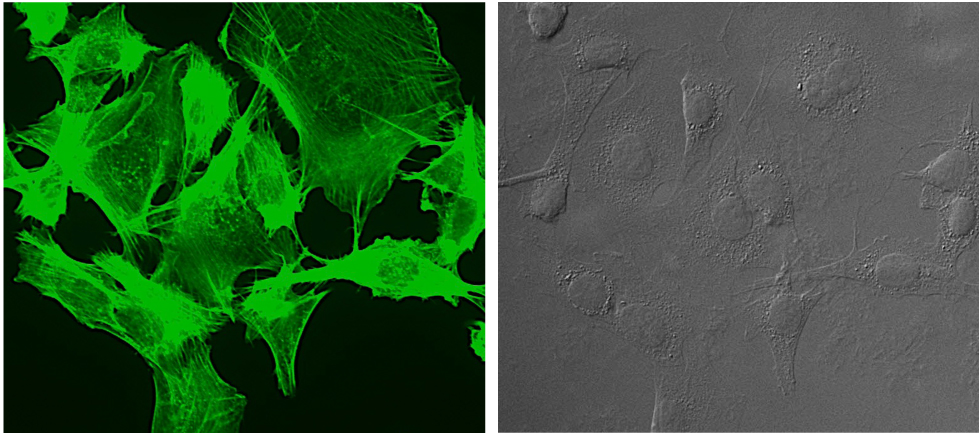 Bilder av aktinskelettet.