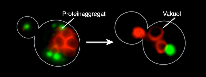 Skadade proteiner klumpar ihop sig till proteinaggregat på flera platser inne i cellen.