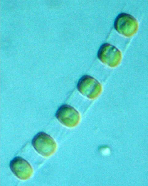 Mikroskopisk bild av Skeletonema