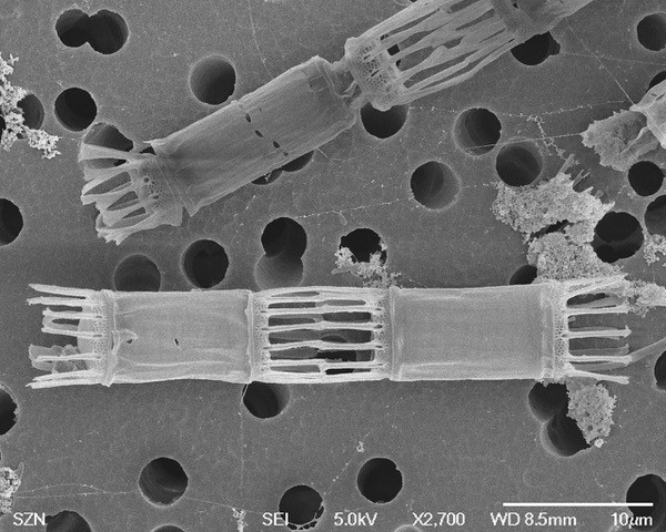 Mikroskopisk svartvit bild av Skeletonema