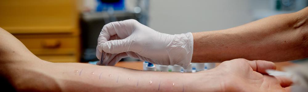 A skin prick test is performed on a patient's arm.