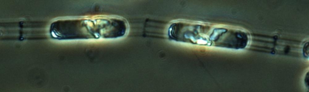 Bild på växtplankton i mikroskop