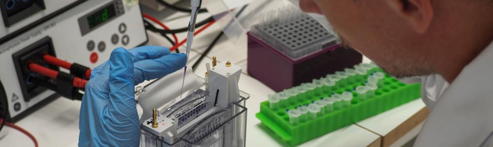 Protein analysis with SDS-PAGE and Western blot