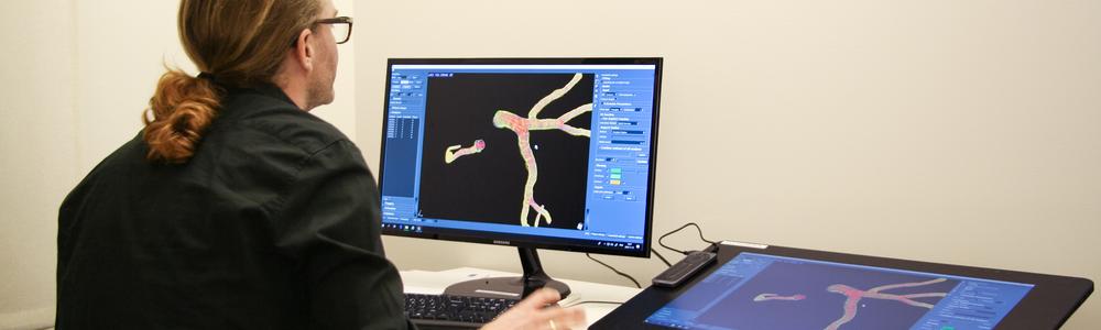 Djupinlärningsmodeller lär sig att att automatiskt analysera kranskärl i en skiktröntgen med hjälp av utlinjeringar gjorda av en expert.