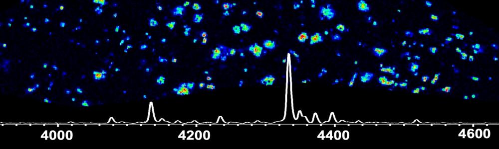 Mass spectrometric imaging of beta-amyloid in brain tissue in Alzheimer patients.