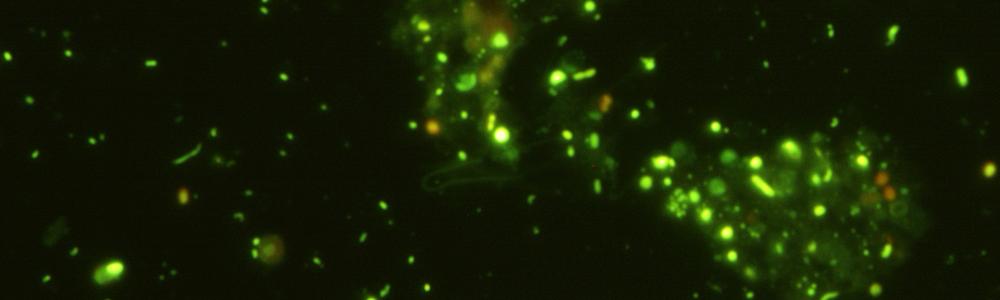 Mikrober i havsvatten fotograferade i ett fluorescensmikroskop.