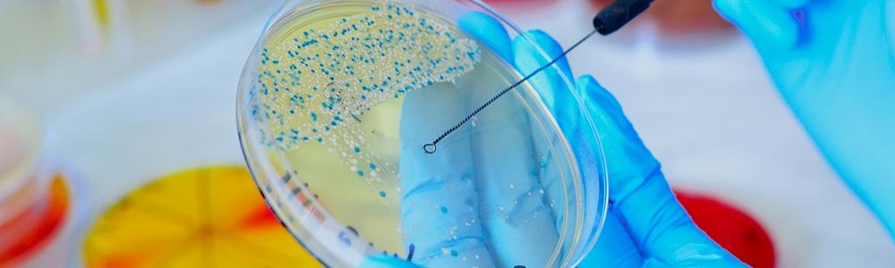 Händer som håller i en petriskål på labb.