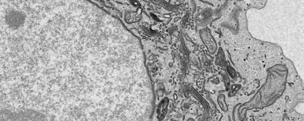A Golgi apparatus cluster in a HeLa cell prepared for serial block face-SEM, imaged using Talos L120C