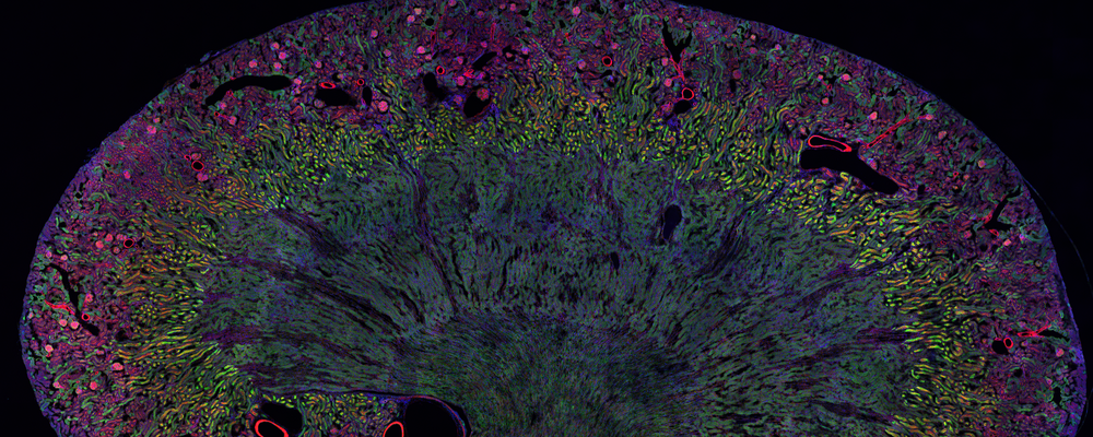 Confocal microscopy overview of a mouse kidney section