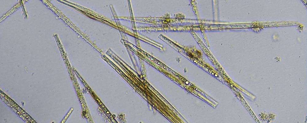 Microskopic image algae Tabularia tabulata