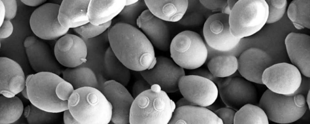 Saccharomyces cerevisiae budding as seen by scanning electron microscopy 