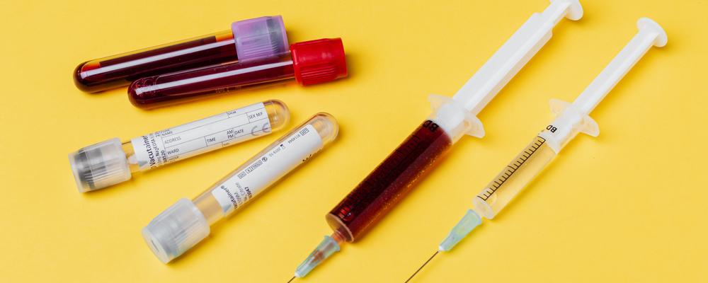 Blood and urine tests