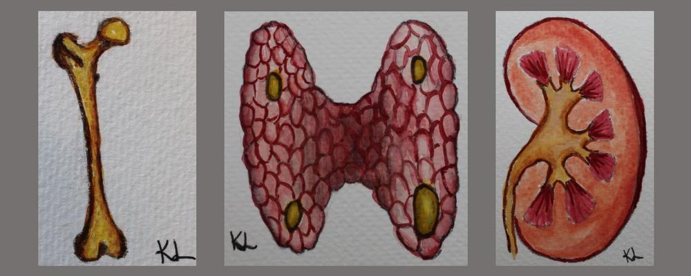 Cover illustration: Three drawings - femur, thyroid gland with four parathyroid glands, one of which is enlarged due to a glandular tumor, kidney. Illustrator: Karolina Lundstam