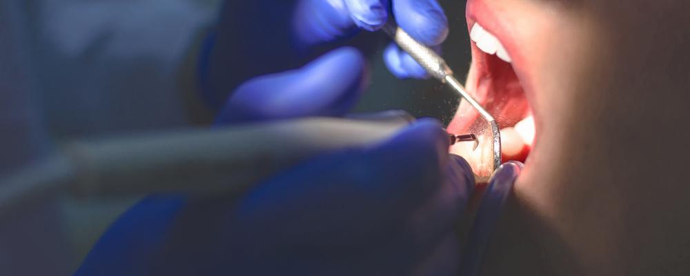 Foto på en tandläkarundersökning