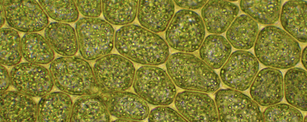 Cells of liverwort Porella