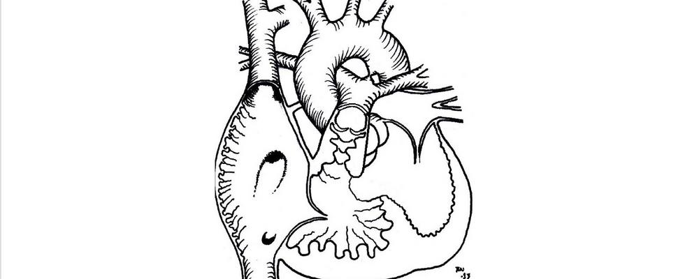 Omslagsillustration; Fallots tetrad, ett av tre medfödda hjärtfel som ingick i studien. 