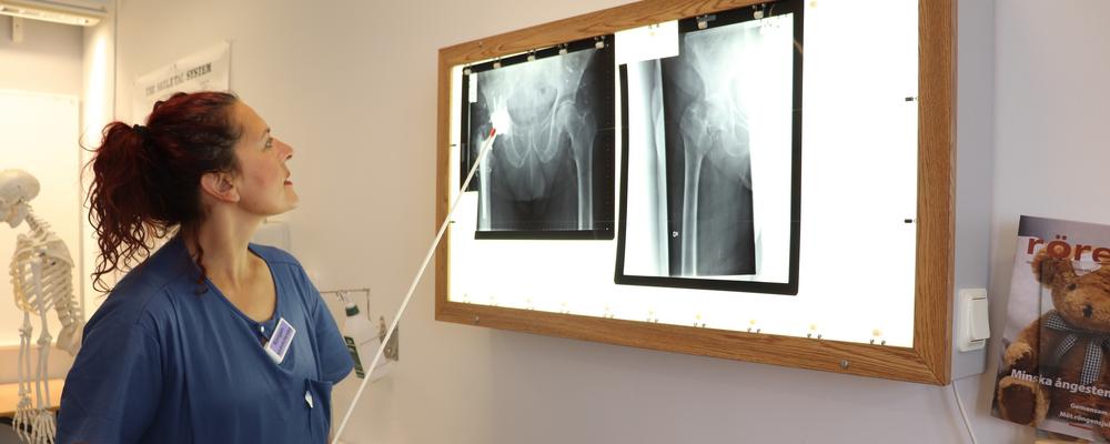 Läraren Mirjana Kustrimovic visar röntgenbilder på ljusskärm