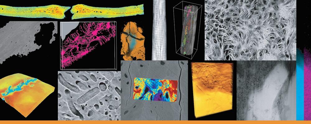Cover illustration: Examples of multimodal and multiscale characterization of bone and bone interfaces from the studies in this thesis, including both images and hyperspectral maps, as well as two- and three-dimensional techniques. 