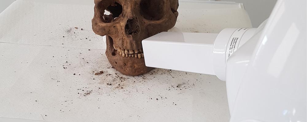 Vikingatänder från Varnhem röntgas