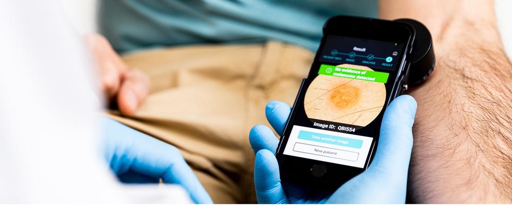Mobilappen tar bild av hud för analys