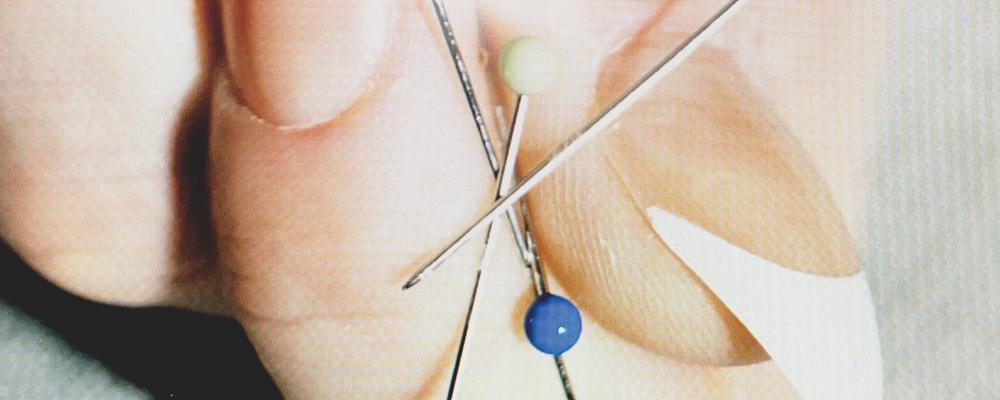 Photo of fingers holding three button needles