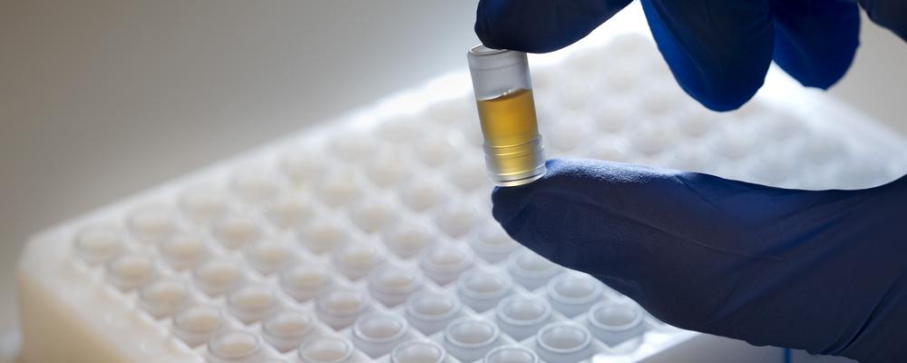 Biobank Väst