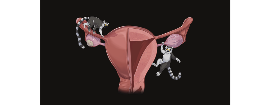 Omslagsillustrationen visar en klassisk bild av äggstockar och livmoder, med en markerad tumör och två klättrande lemurer. Lemurerna anspelar lekfullt på LMTK3 (Lemur Tyrosine Kinase 3), som är en av biomarkörerna som undersöks i avhandlingen. Illustratio