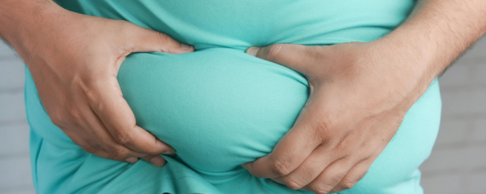 Person who is obeses