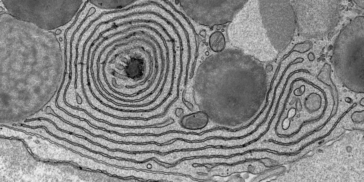 Chemical fixation and epoxy embedding University of Gothenburg
