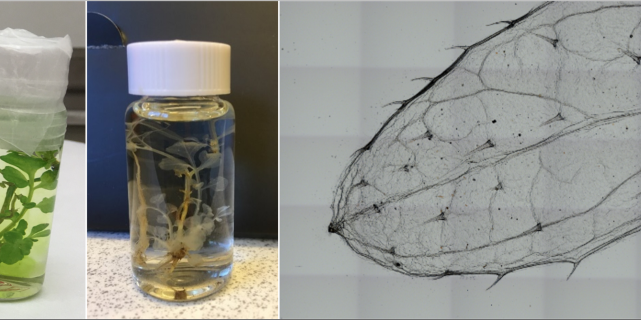 Tissue clearing University of Gothenburg