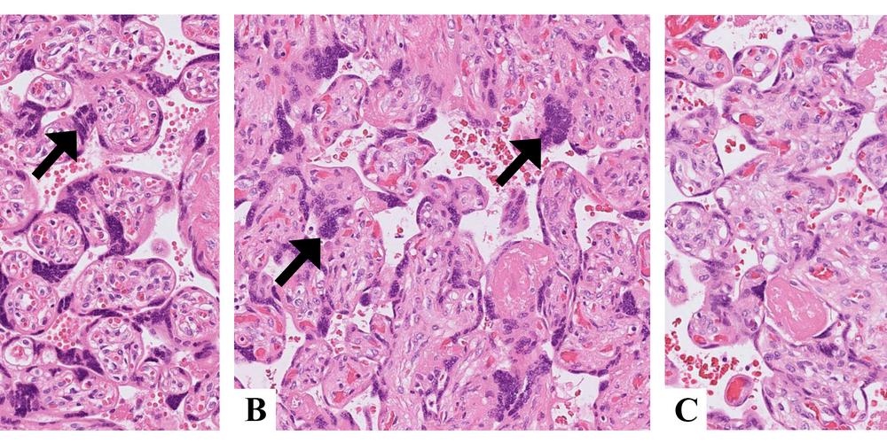 tre rosafärgade histologiska bilder med cellstrukturer bredvid varandra