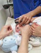 Foto av tidigt fött barn som undersöks för ögonsjukdomen ROP