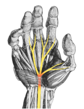 Figure 2. Palm side of the hand, showing the median nerve.