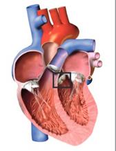 Illustration av normalt hjärta med aortaklaffen inramad. Från sammanfattningen sid 5 i avhandlingen.