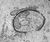 Transmision electron microscopy image of an autophagosome