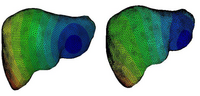 Displacement fields on a liver finite element model subjected to two different loading conditions.