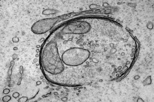 TEM image autophagosome