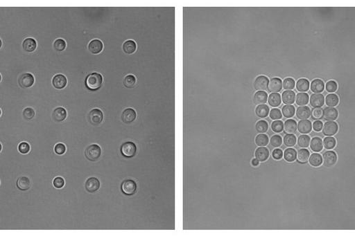 Two cell arrays of budding yeast inside a microfluidic chamber displaying the applicability of optical tweezers in biophysics.