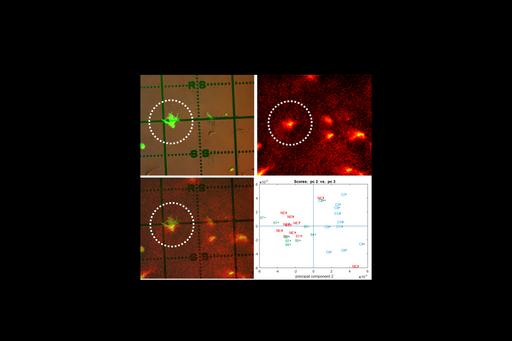 Single cell lipidomics