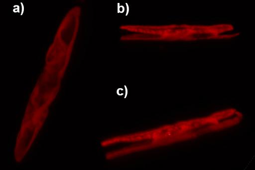 Chloroplasts in a benthic diatom, photographed with a confocal microscope.