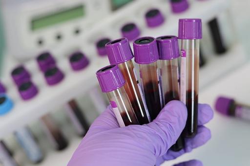 Blood samples in a testtube 