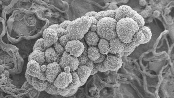 TAT Radiation physics