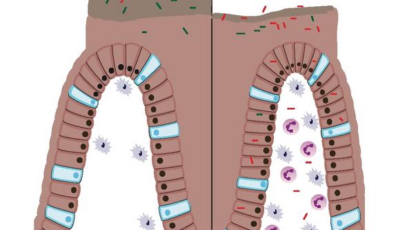 Illustration av tjocktarmen med slem och bakterier