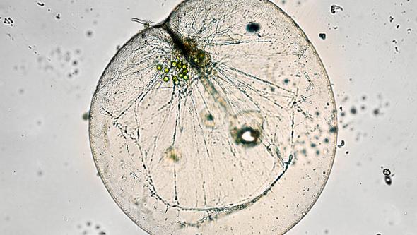 A single-celled algae.
