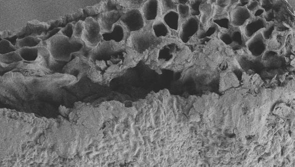 Microscopic picture of bladderwack with porous structure