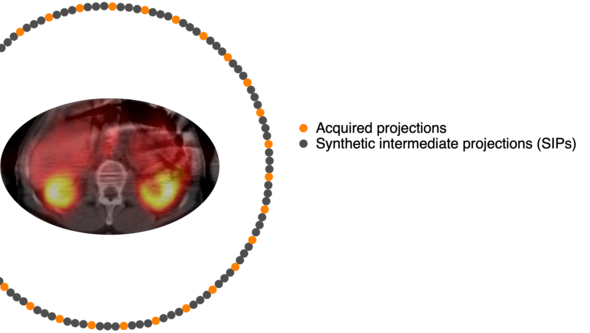 Figur 9 från avhandlingen: Cirklar som representerar detektorpositioner under SPECT-insamling. 30 insamlade projektioner (orange