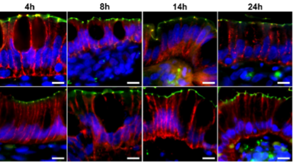 Luminal preservation and tissue control visualizing ZO-1 (green) and claudin-3 (red) at 8, 14 and 24 hours. Read more explanatio