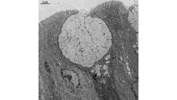 Grayscale micrograph of a goblet cell with a large, pale, rounded top.